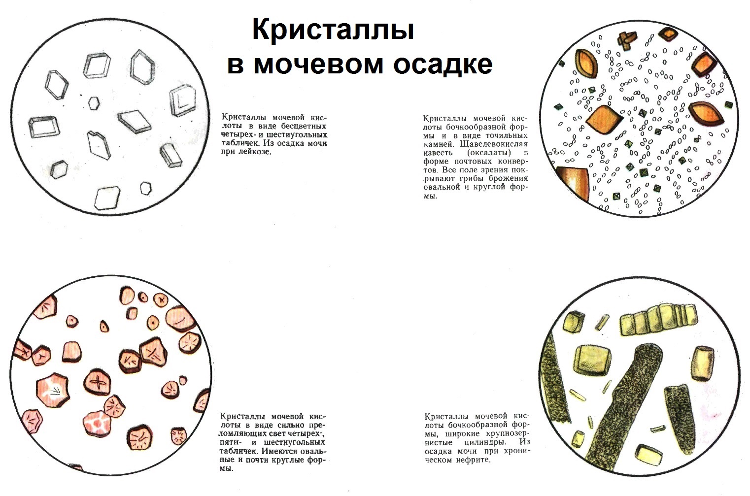 Микроскопия мочи бактерии