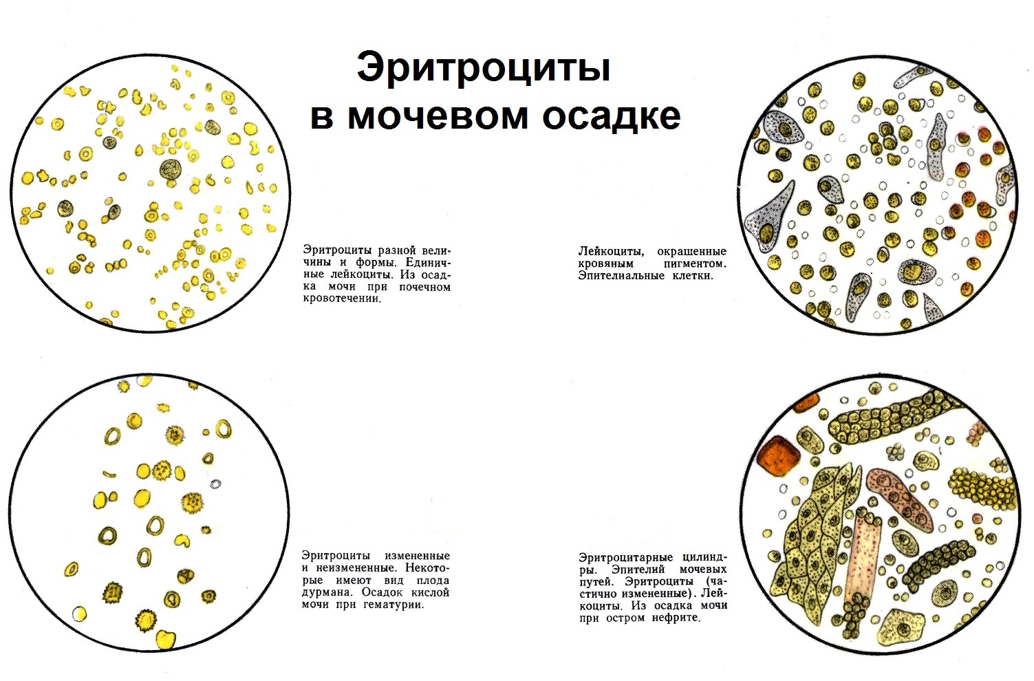 Моча микроскопия осадка нормы и отклонения